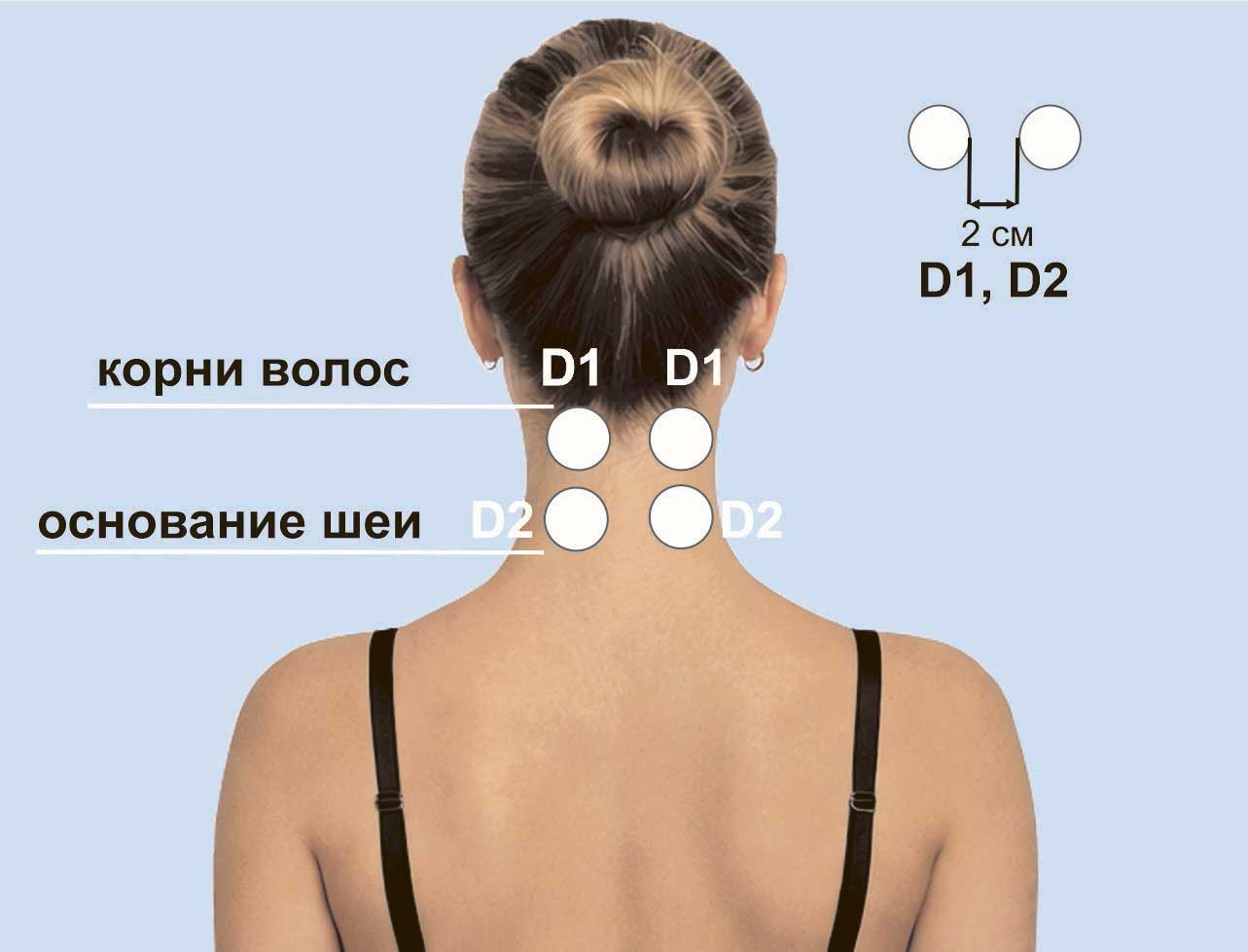 Области воздействия при дискулаторной энцефалопатии