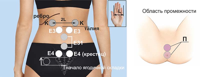 Схема областей воздействия при геморрое: точки Е3, Е31, Е4 и область промежности