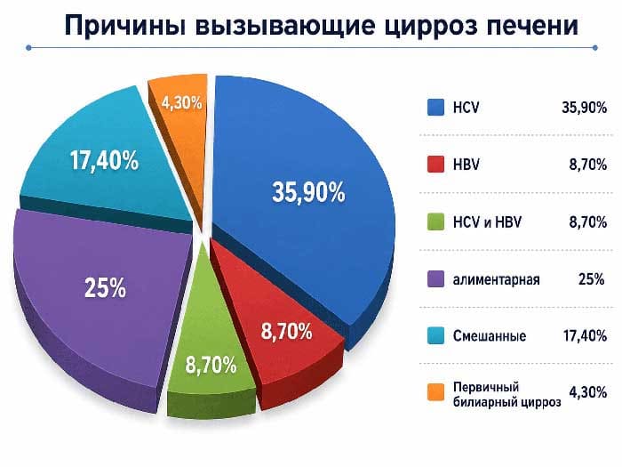 Диаграмма причин развития цирроза печени: HCV, HBV, алиментарные и смешанные причины