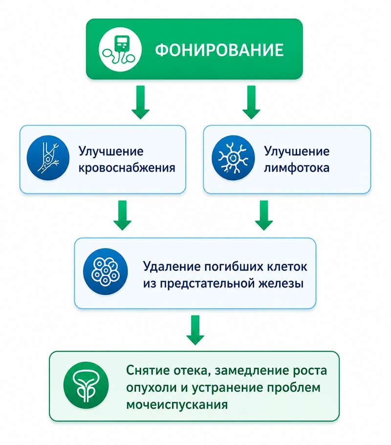 Фонирование - эффективное средство лечения аденомы простаты без лекарств и операции