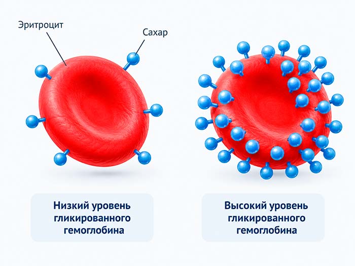 Определение уровня гликированного гемоглобина для выявления сахарного диабета
