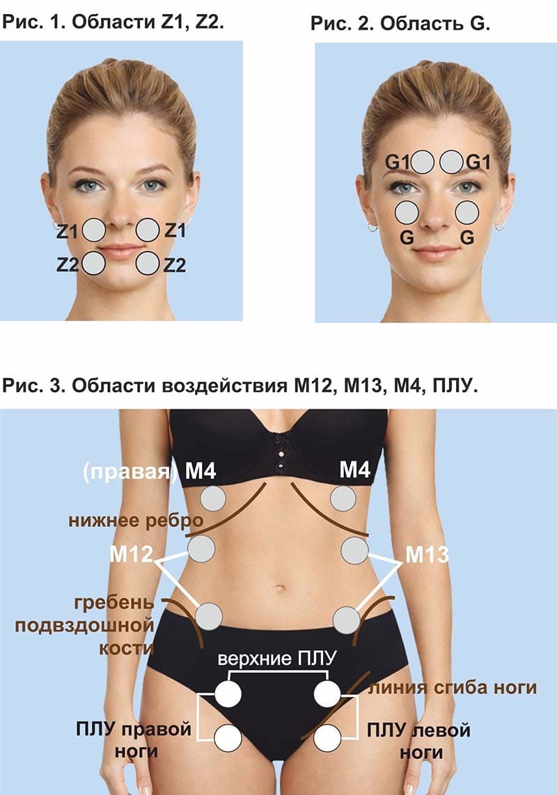 Области воздействия и места установки виброфонов. Рис. 1-3