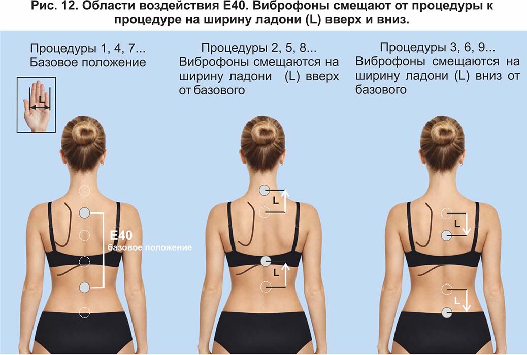 Области воздействия Е40