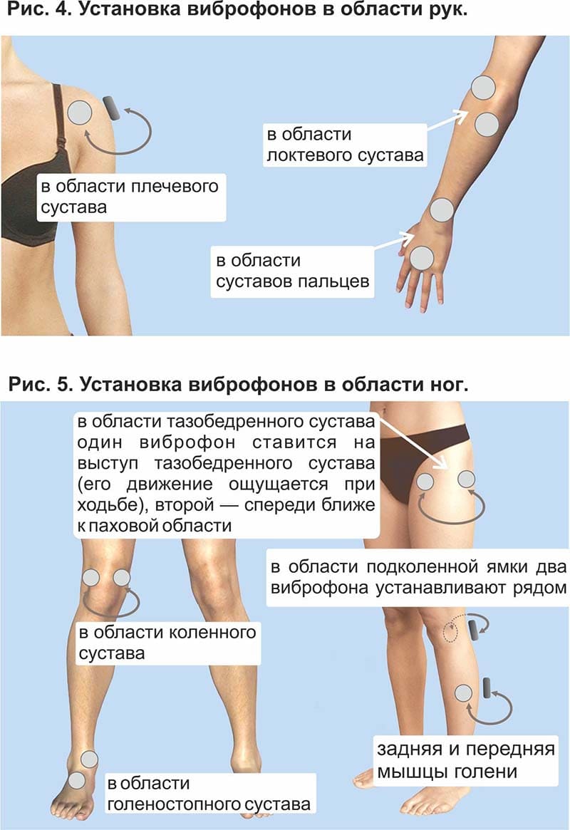 Области воздействия и места установки виброфонов. Рис. 4 и 5