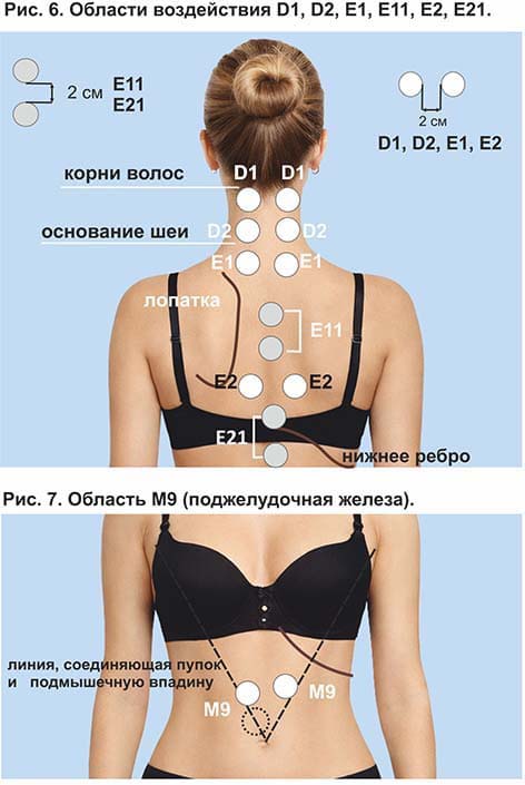 Области воздействия и места установки виброфонов. Рис. 6